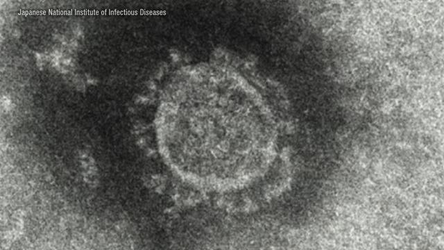 Япония сообщила о втором по величине суточном числе заражений коронавирусом