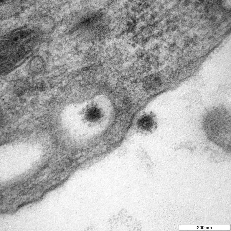 СМИ: дельта-штамм коронавируса мог самоликвидироваться в Японии