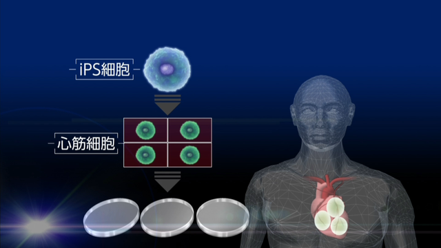 В Токио проведена операция по пересадке клеток сердечной мышцы, полученных из iPS-клеток
