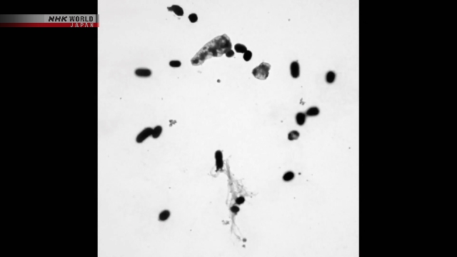 Японский исследовательский институт начнет изучать устойчивые к лекарствам бактерии вместе с другими азиатскими странами