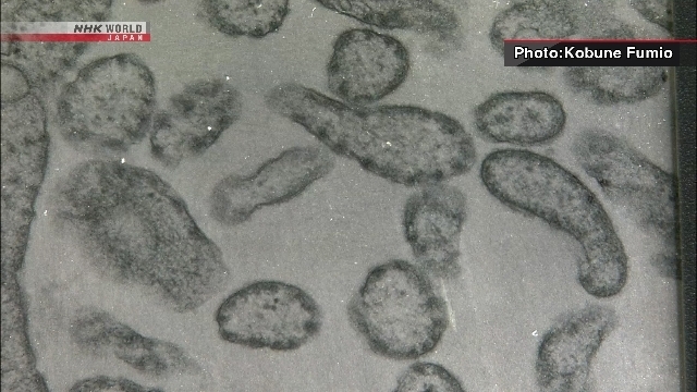 Число случаев заболевания корью в Японии в этом году превысило 200